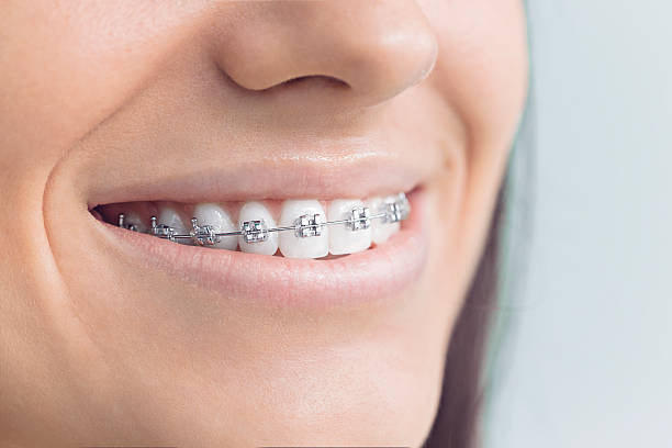 Best Traditional Braces  in Cramerton, NC